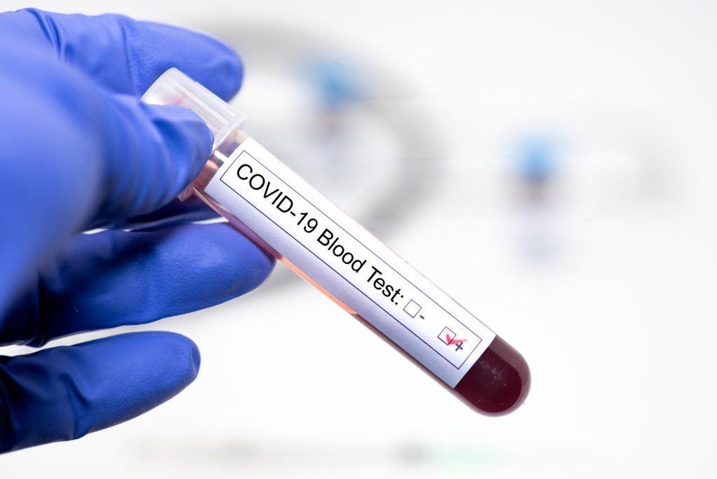 ¿Cómo funcionan y en qué se diferencian las PCR y los test rápidos de coronavirus?