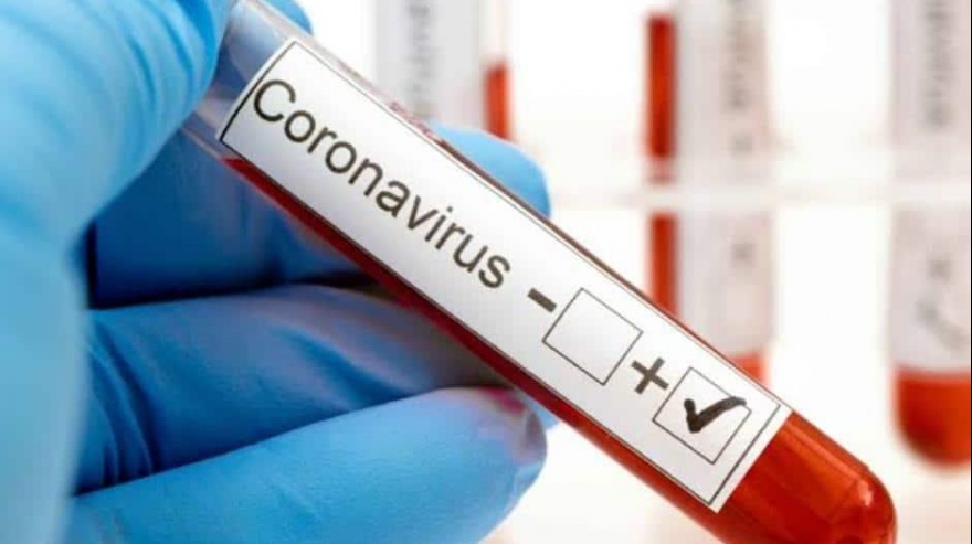 Parte epidemiológico de la Municipalidad de Funes del 03 de agosto